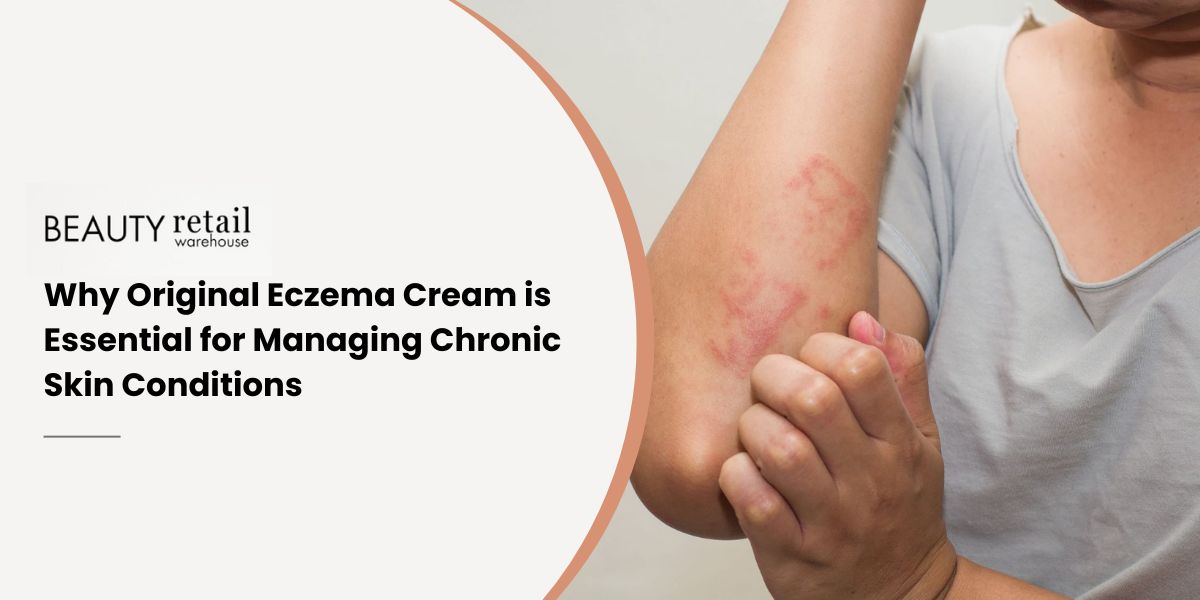 Why Original Eczema Cream is Essential for Managing Chronic Skin Conditions